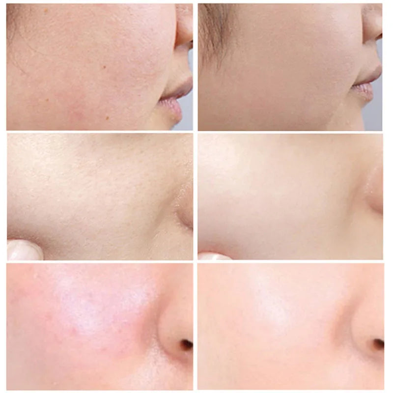 7 Day Repair Redness Serum Sooth Itching Sensitive Skin Improve Rosacea Shrink Pore Smooth Nourish Facial Skin Korean Cosmetics