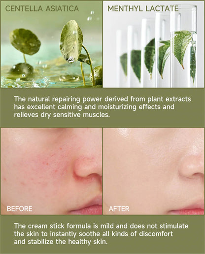 7 Day Repair Redness Serum Sooth Itching Sensitive Skin Improve Rosacea Shrink Pore Smooth Nourish Facial Skin Korean Cosmetics