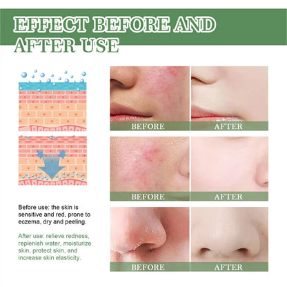 7 Day Repair Redness Serum Sooth Itching Sensitive Skin Improve Rosacea Shrink Pore Smooth Nourish Facial Skin Korean Cosmetics