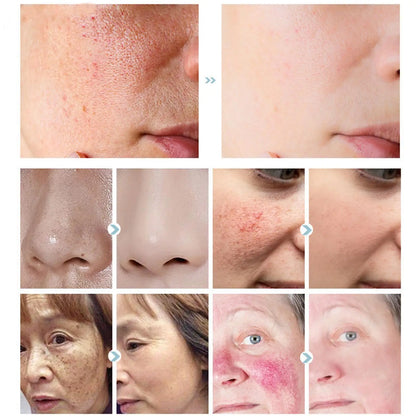 7 Day Repair Redness Serum Sooth Itching Sensitive Skin Improve Rosacea Shrink Pore Smooth Nourish Facial Skin Korean Cosmetics