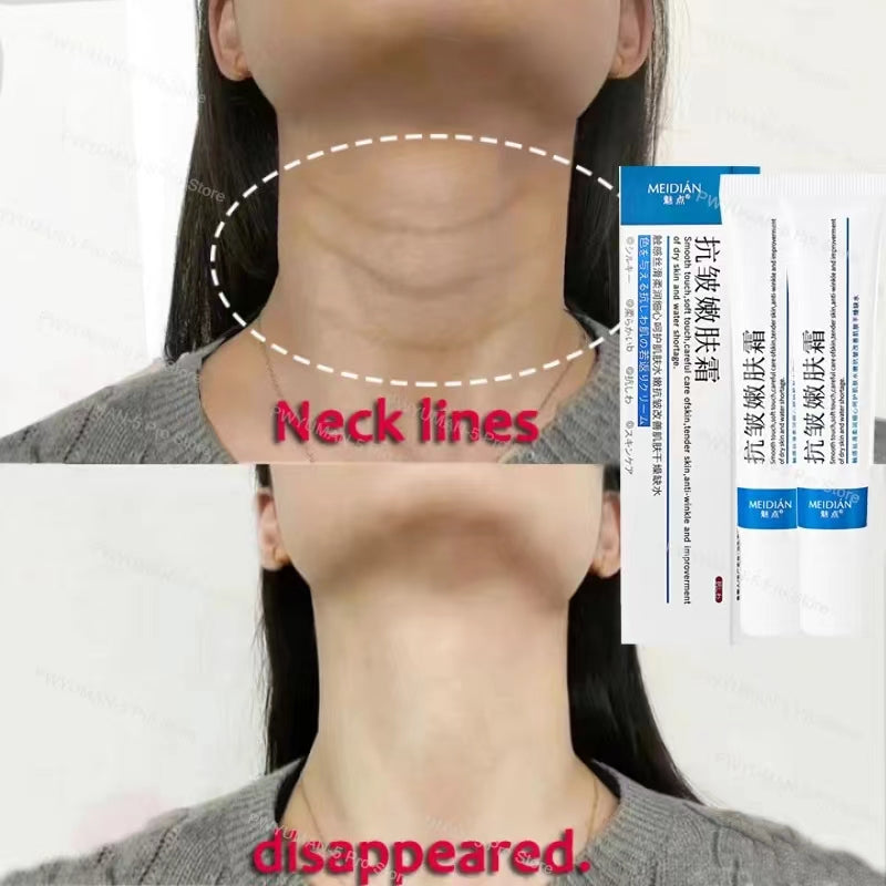 Collagen Neck Cream Eliminate Neck Wrinkle Lines Lifting Whitening Tighten Double Chin Anti-age Rejuvenation Skin Care Cream