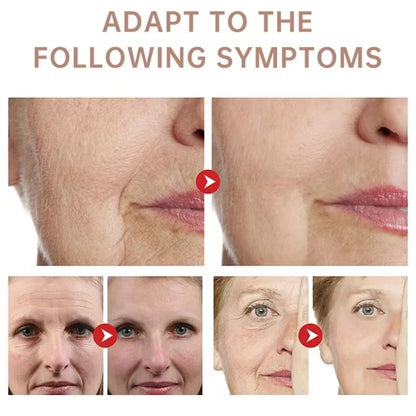 Collagen Neck Cream Eliminate Neck Wrinkle Lines Lifting Whitening Tighten Double Chin Anti-age Rejuvenation Skin Care Cream