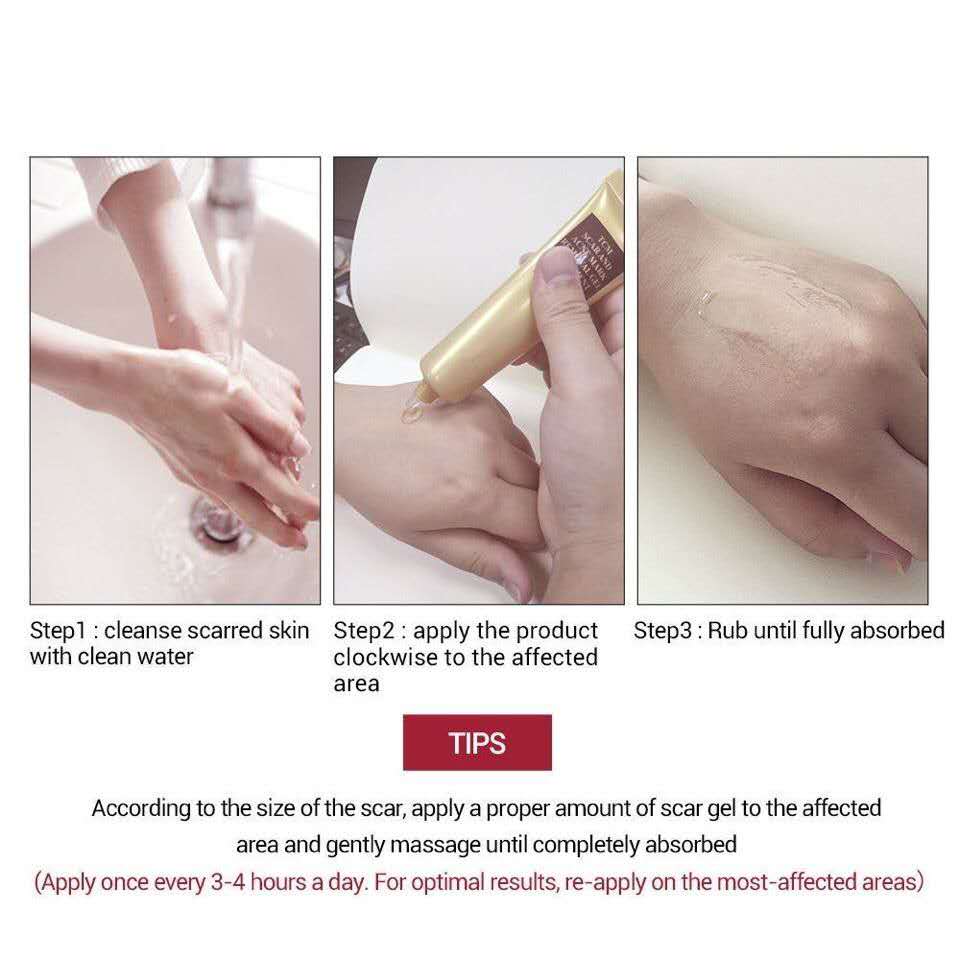 TCM Scar Acne Mark Removal Gel Ointment, 30g