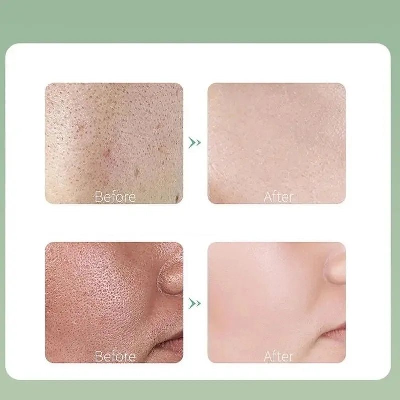 Deep Cleansing Mask (4g×12pcs/Box) (Available) - Mom & Kids